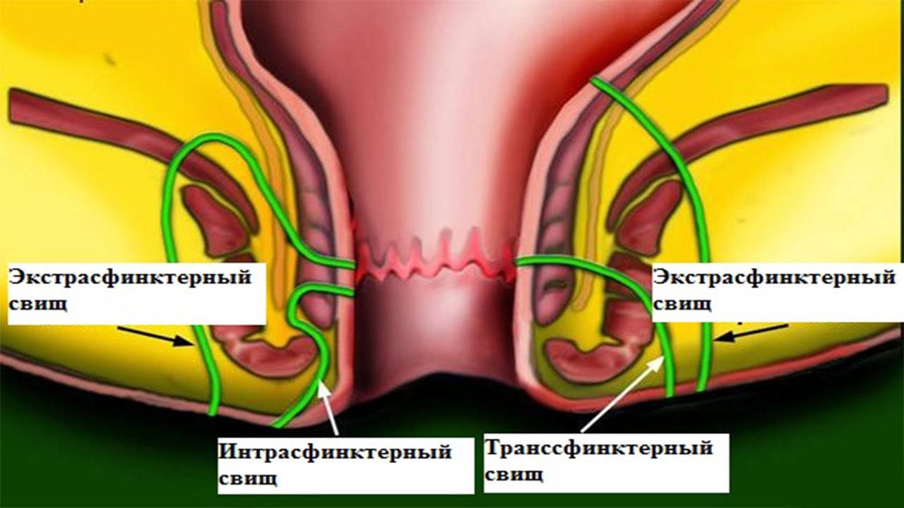 Горячая девка показывает анус с вытекающей спермой после анального секса