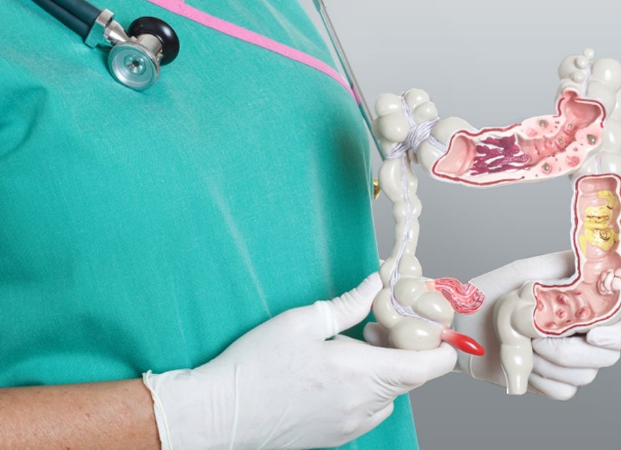 Анализы при геморрое