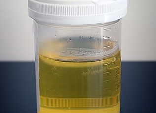 Уринотерапия при геморрое