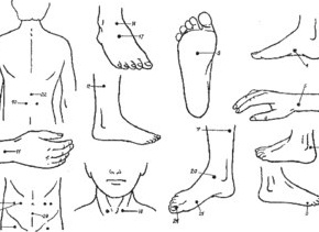 Акупунктура от геморроя