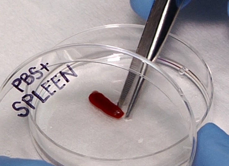 Выделения из анальности