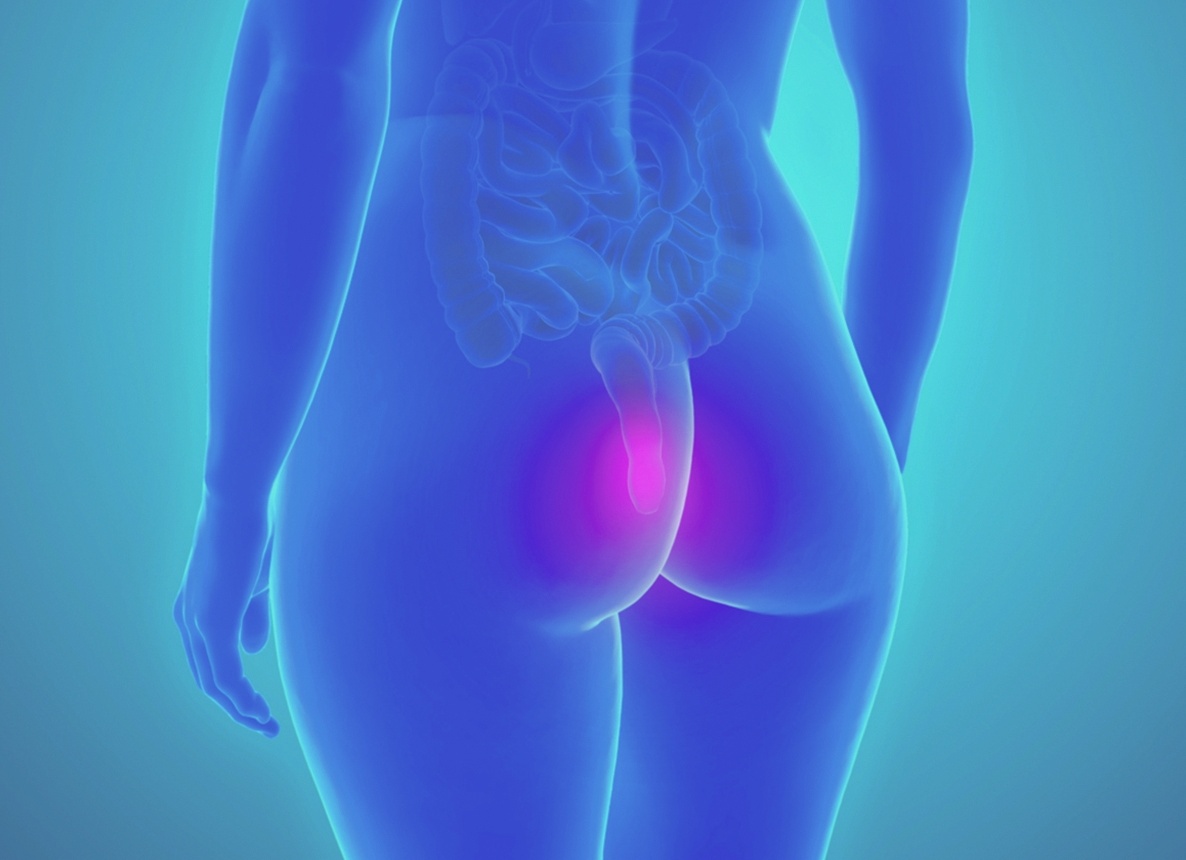 Может ли при геморрое болеть нога?