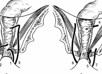 Операция по Габриэлю