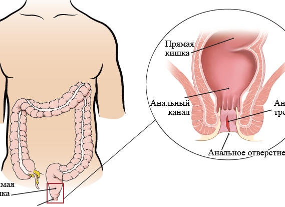 Дискомфорт в анальности