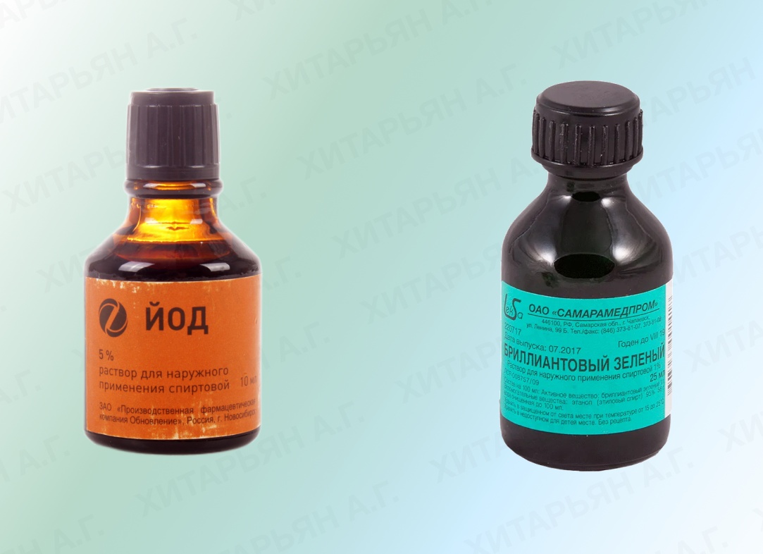 Лечение геморроя йодом и зеленкой