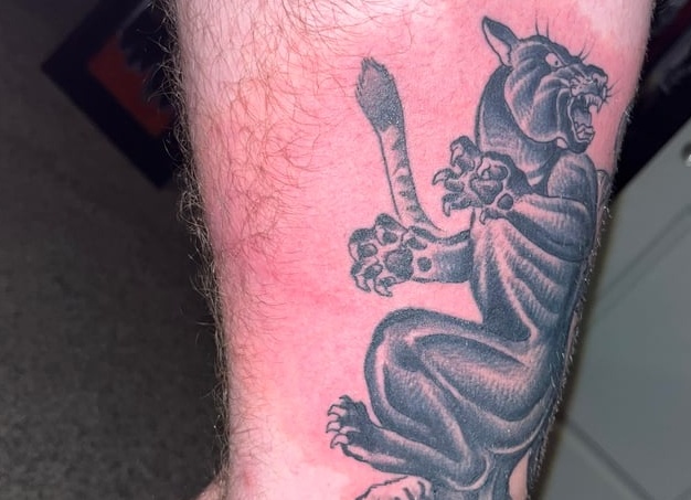 Когда геморрой зашел далеко: выделение гноя и лечение с устранением причины