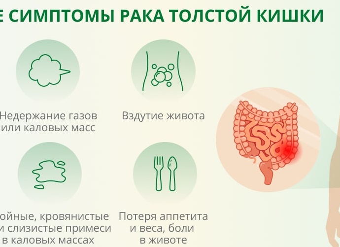 Болевой синдром при раке прямой кишки